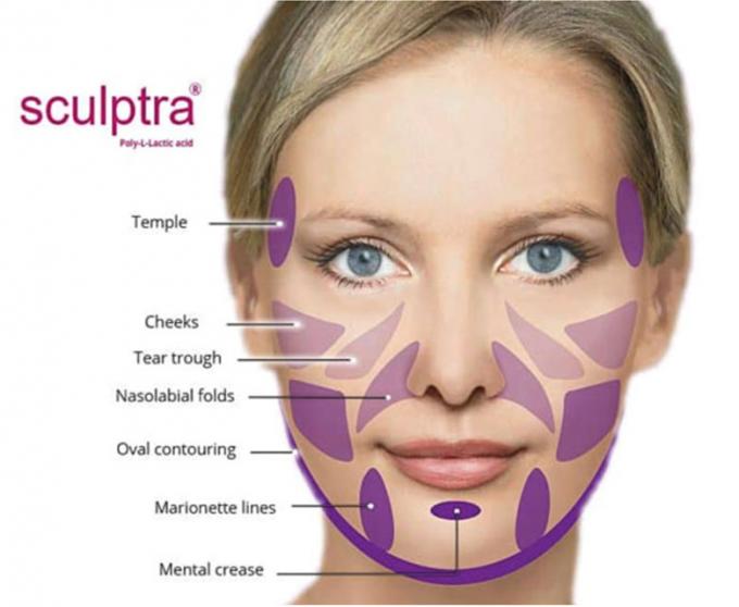 Sculptra Skin Lifting • Junglinster, Luxembourg • Advance Aesthetics