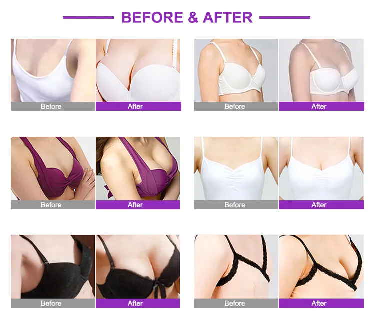 Aspirazione a vuoto Butt Lifting Cups Pump Therapy Maschera di ingrandimento del seno 4