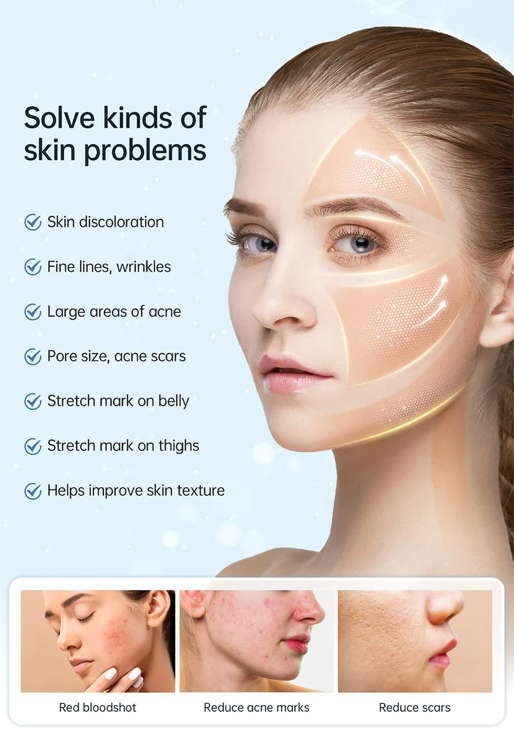 Nuova Hydra Pen H5 Serum per infusioni EMS e Microneedling Applicazione automatica 4