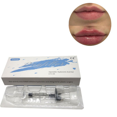 Nuovo riempitore cutaneo con acido ialuronico profondo 2 ml 5 ml incrociato