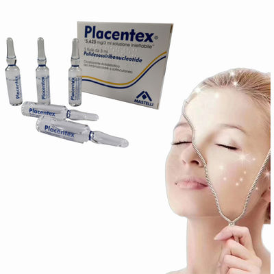 3 ml di riempitivi cutanei a base di polidesoxi ribonucleotidi per le cicatrici dell' acne